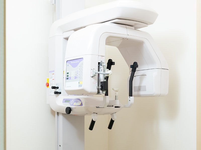 デジタルレントゲン